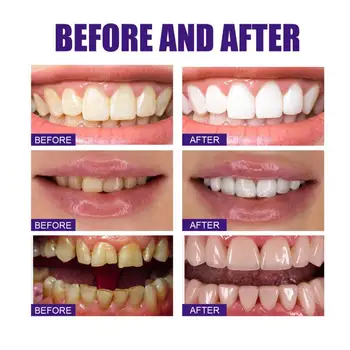 10PCS Mousse Zob zobna pasta Osvežitev Dih Čiščenje In Osvetlitev Ustne Higiene Madeže Odstranitev Dentifrice Nego Zob