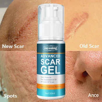 Napredno Scar Removal Cream Akne, Mozolji Strij Popravila Gel Opekline Kirurško Zdravljenje Brazgotin Glajenje Telo, Lepota, Nega Kože