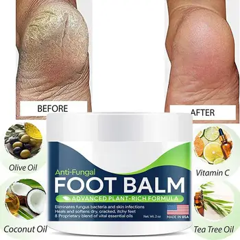 Stopala Pozdravi Vse-Naravni Rastlinski Balzam za Stopala – Rumene Foot Care Krema za Suho Kožo