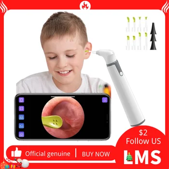 WIFI Uho Otoscope LMS SKP 3.9 mm Pametni Brezžični Prenosni Visual ušesno maslo, Čiščenje Medicinskih Endoskop Kameri iPhone, Telefon Android 0.1