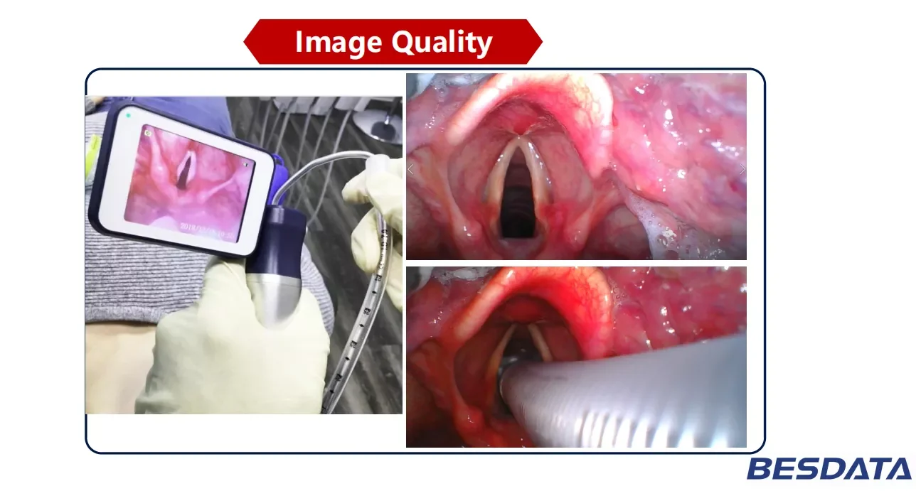 BESDATA prenosni Večkratno uporabo Video Laryngoscope z visoko slikovnih pik in reševanje