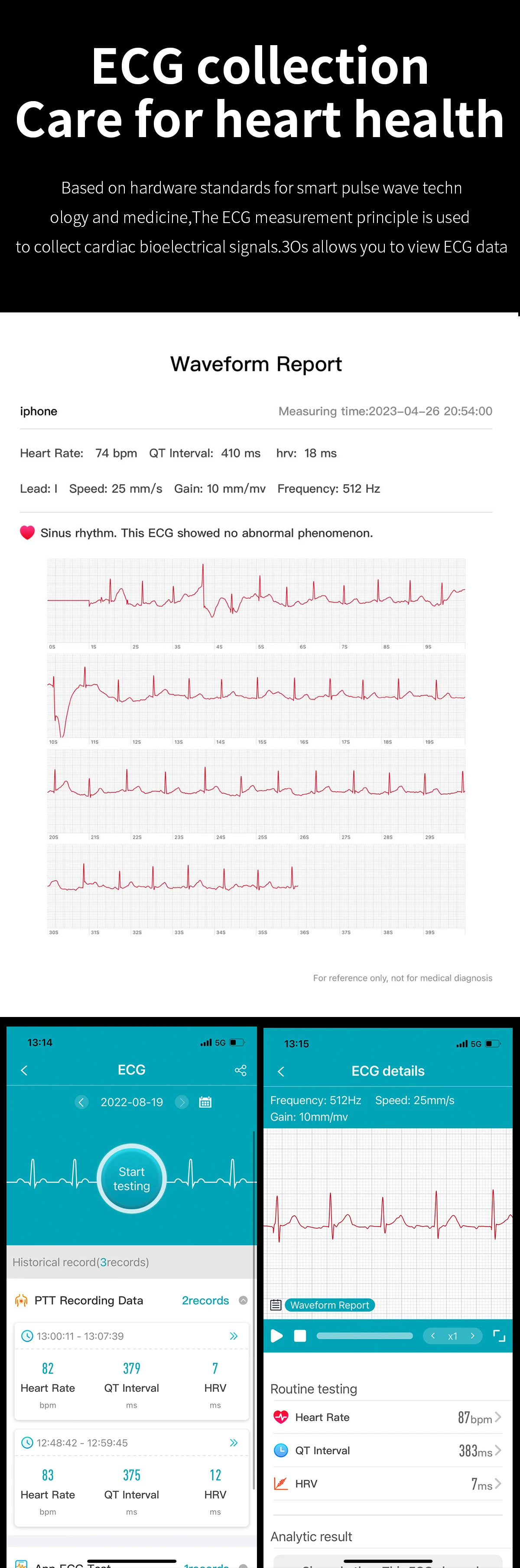 Men ' s Health Smartwatch EKG+PPG SSF glukoze v Krvi Kisika v Krvi, Spremljanje Zdravja Sledenje Žensk smartwatch Za Android IOS